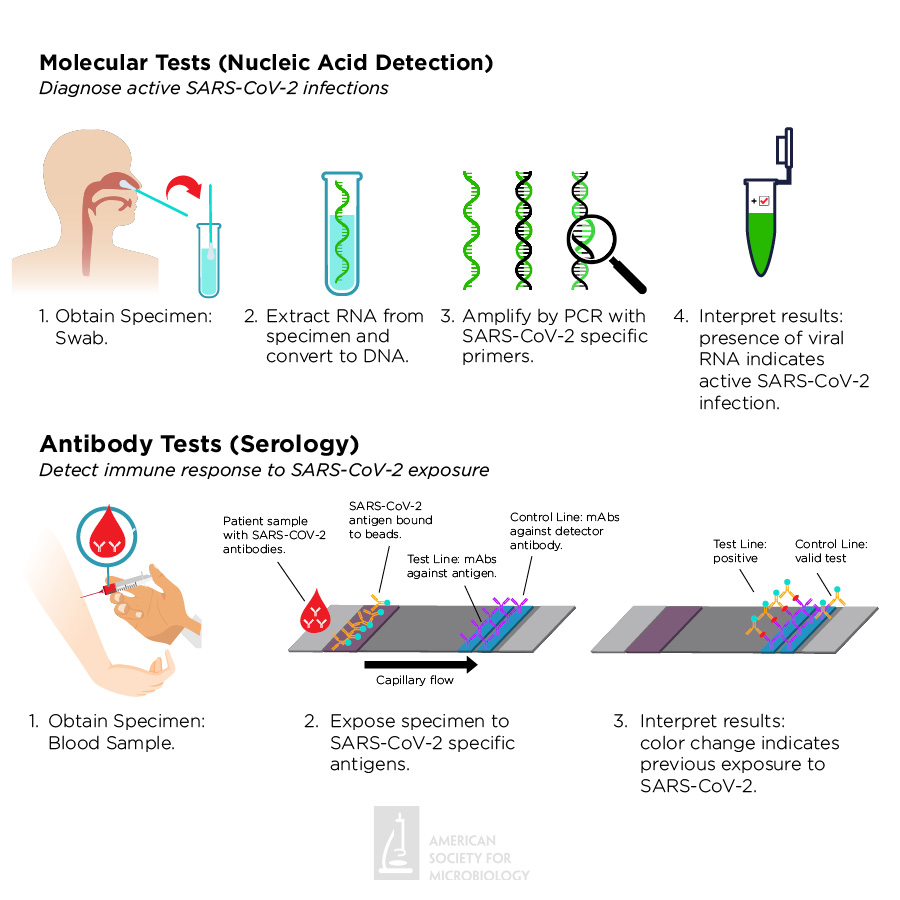 Comparison of SARS-CoV-2/COVID-19 test types and techniques.