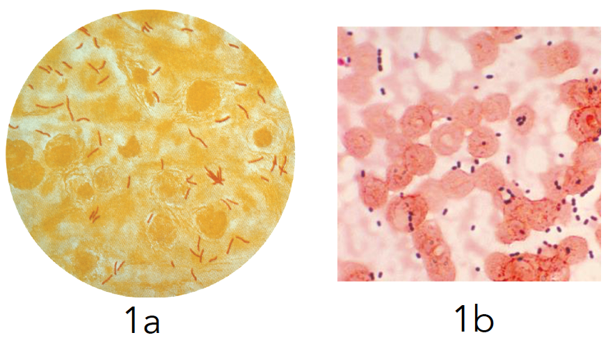 A. Mycobacterium tuberculosis. B. Enterococcus faecalis